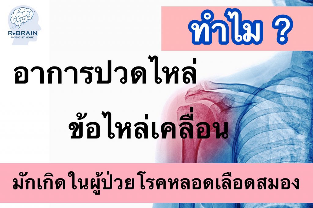 กายภาพบำบัดที่บ้าน