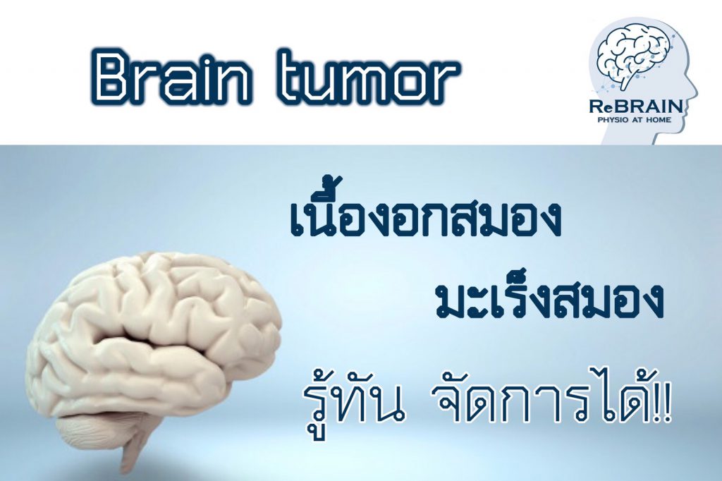 กายภาพบำบัดที่บ้าน