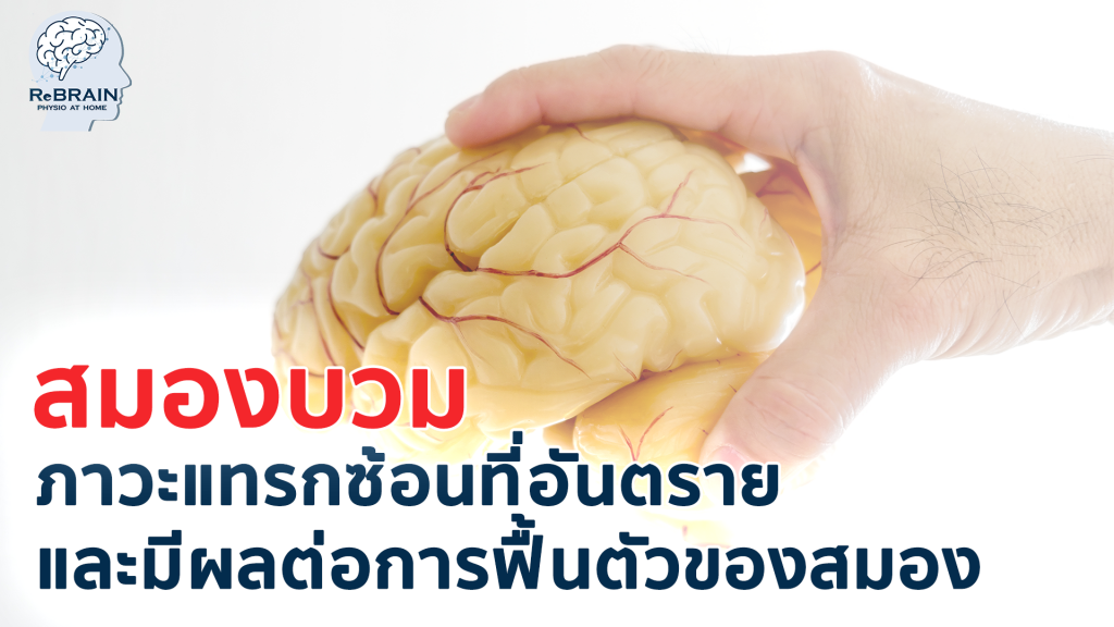 สมองบวม