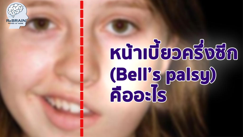 หน้าเบี้ยว