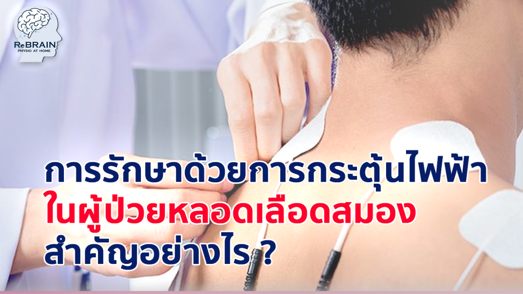 กระตุ้นไฟฟ้า