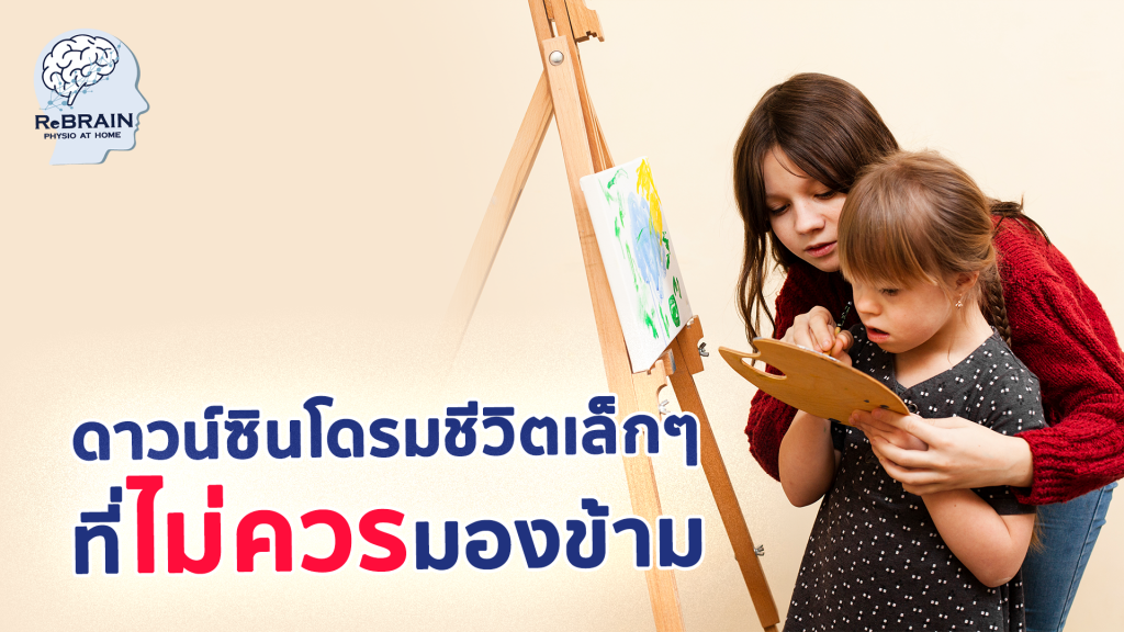 ดาวน์ซินโดรม