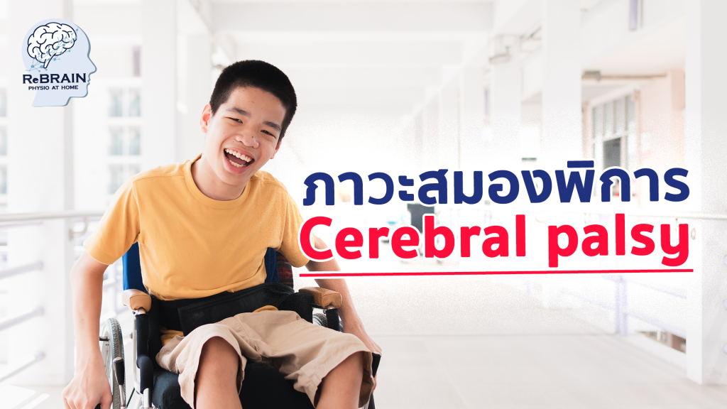 สมองพิการ