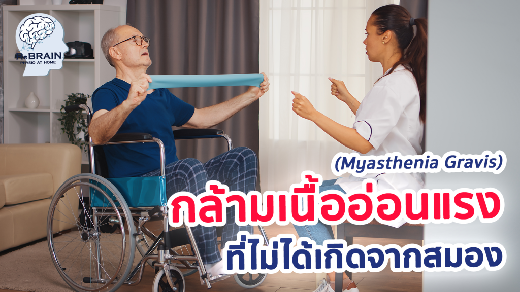 โรคกล้ามเนื้ออ่อนแรง