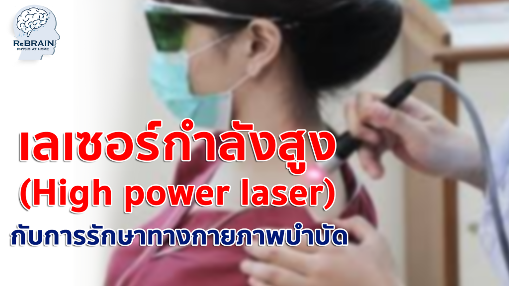 เลเซอร์