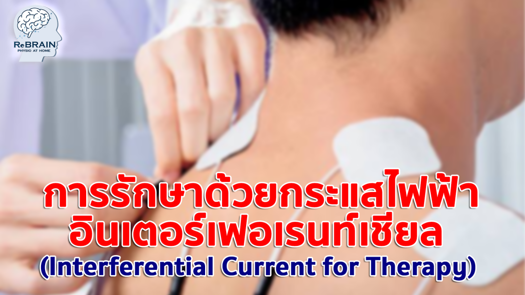 การกระตุ้นไฟฟ้า