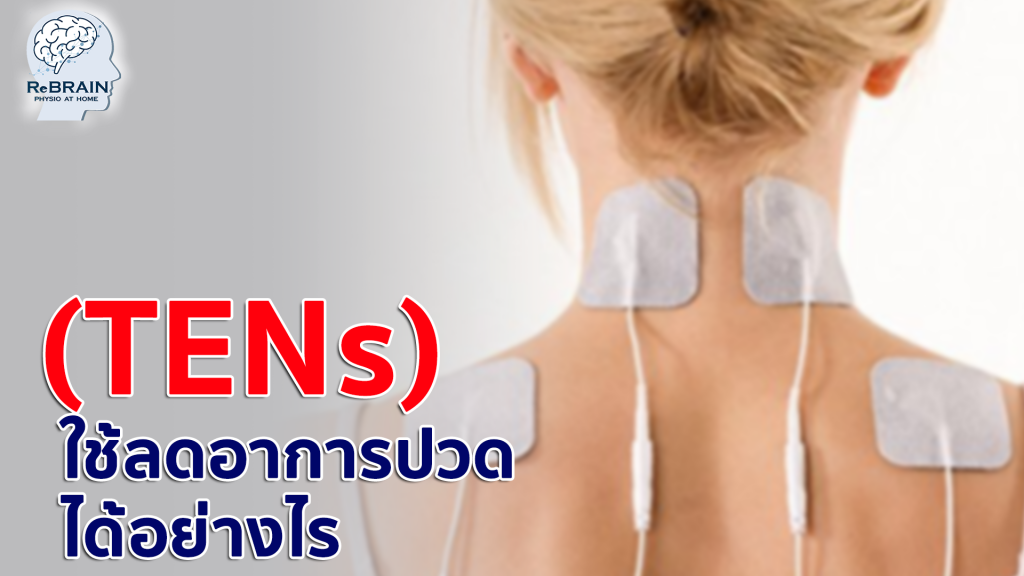 เครื่องกระตุ้น