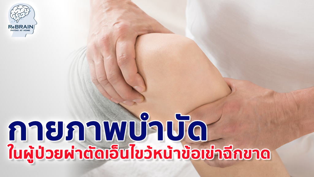 เอ็นไขว้หน้าข้อเข่า