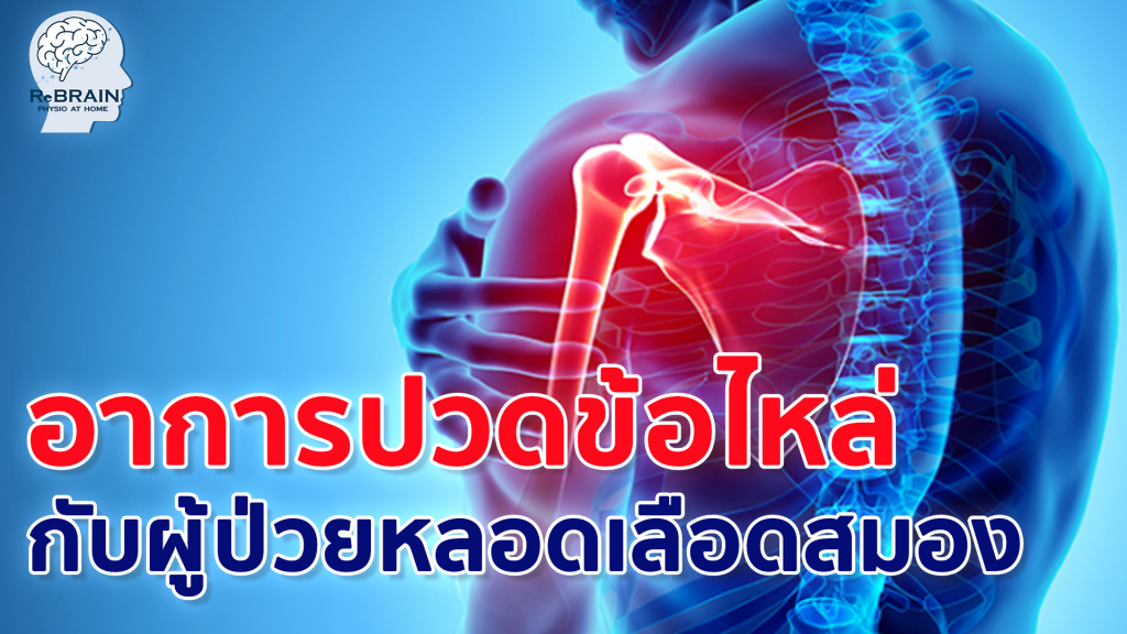 ปวดข้อไหล่