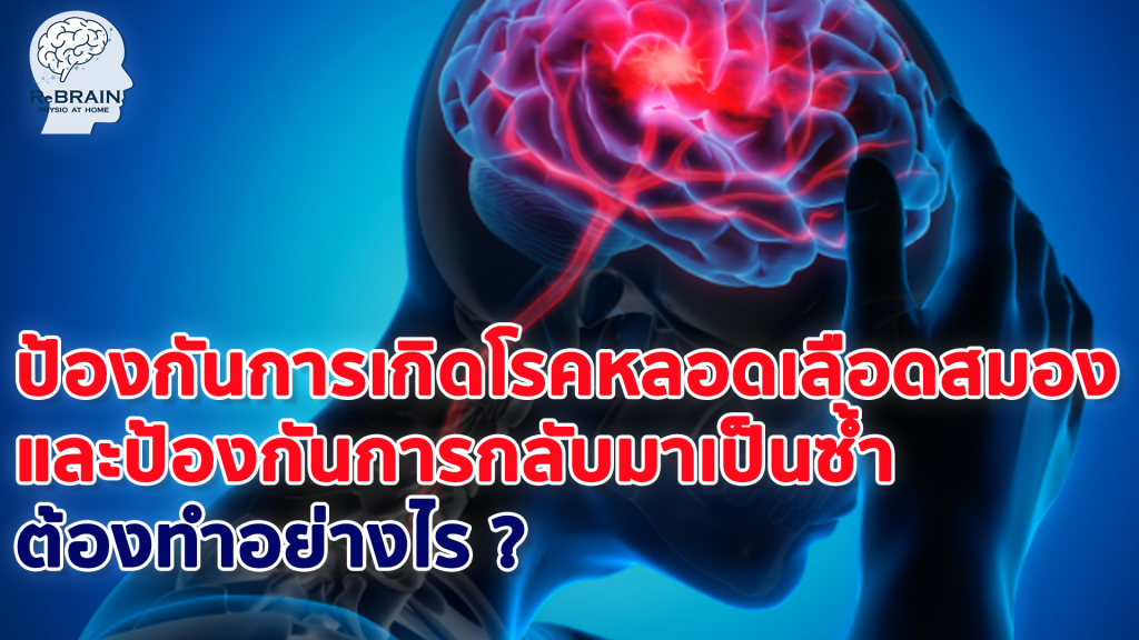 ป้องกันการเกิดโรคหลอดเลือดสมอง