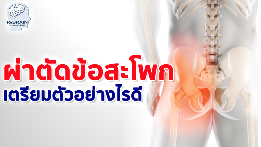 ผ่าตัดข้อสะโพก