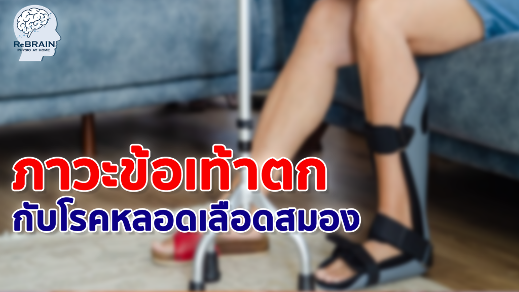 ข้อเท้าตก