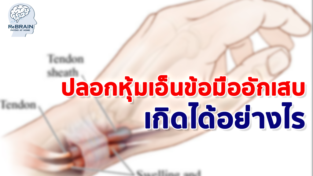 ปลอกหุ้มเอ็นข้อมืออักเสบ