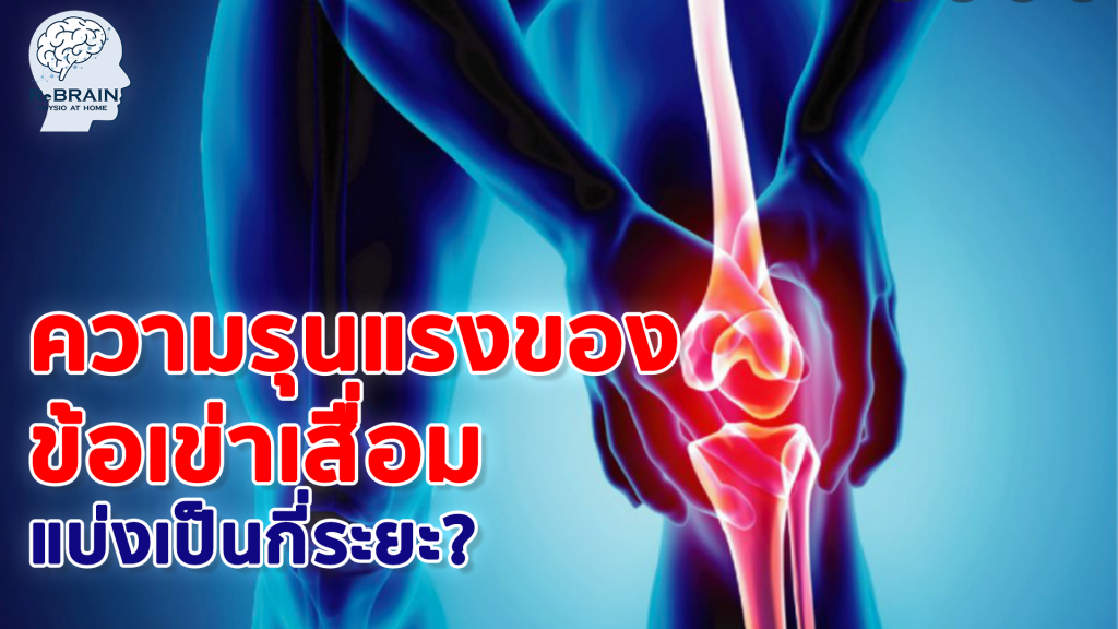 เข่าเสื่อม