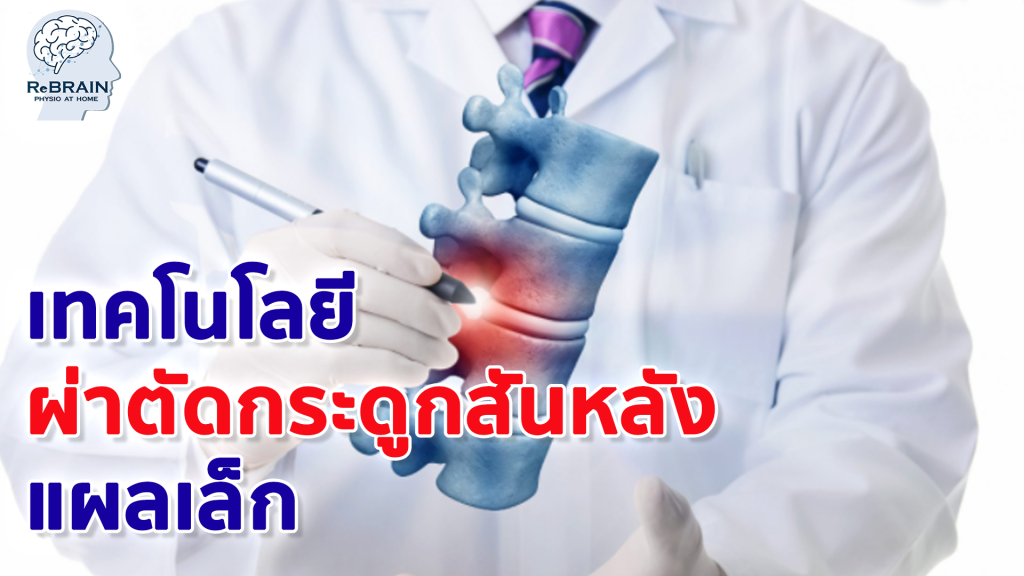 ผ่าตัดกระดูกสันหลัง