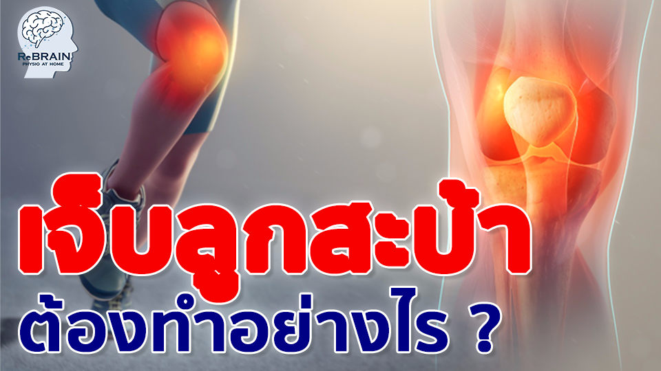 ลูกสะบ้า