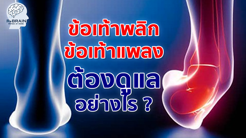 ข้อเท้าพลิก