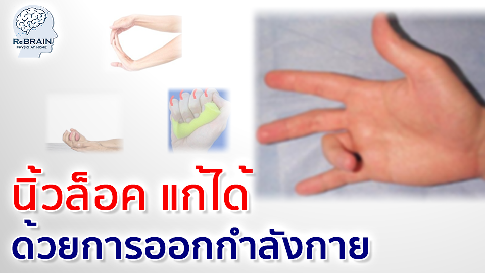 นิ้วล็อค