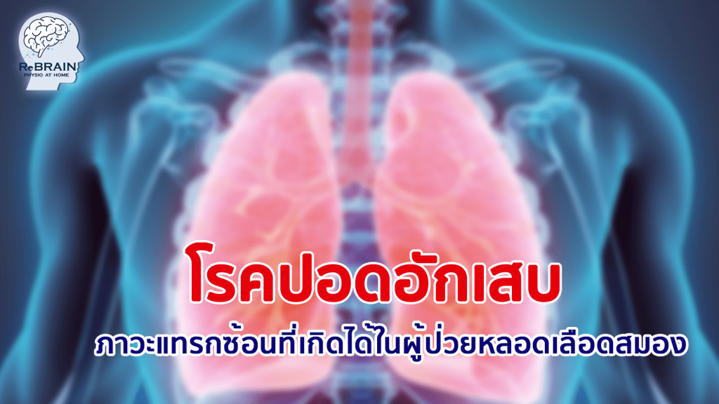 โรคปอดอักเสบ