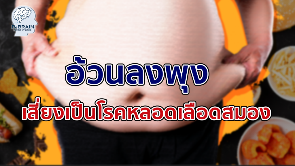 โรคอ้วน