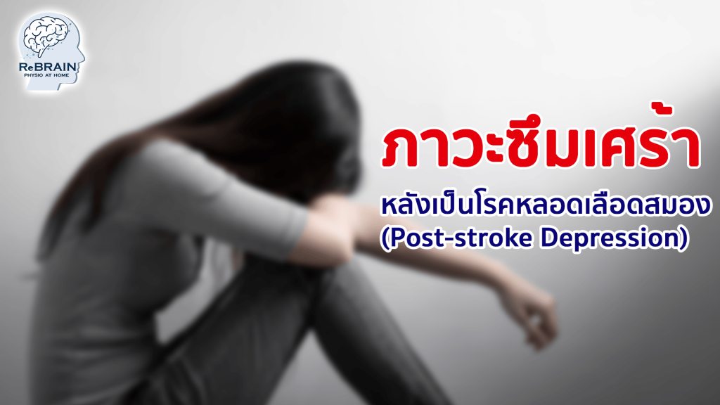 ภาวะซึมเศร้า