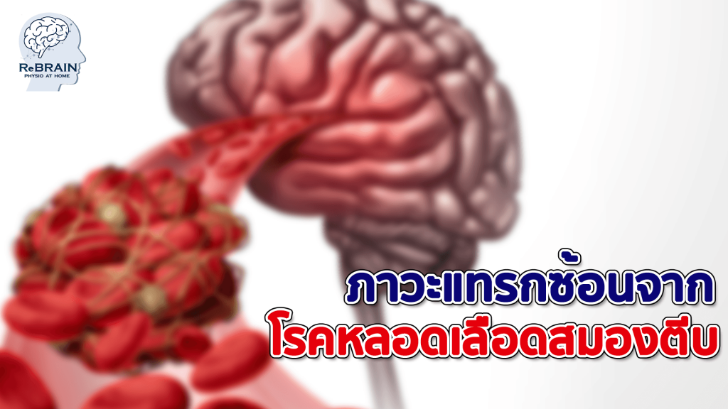 ภาวะแทรกซ้อน