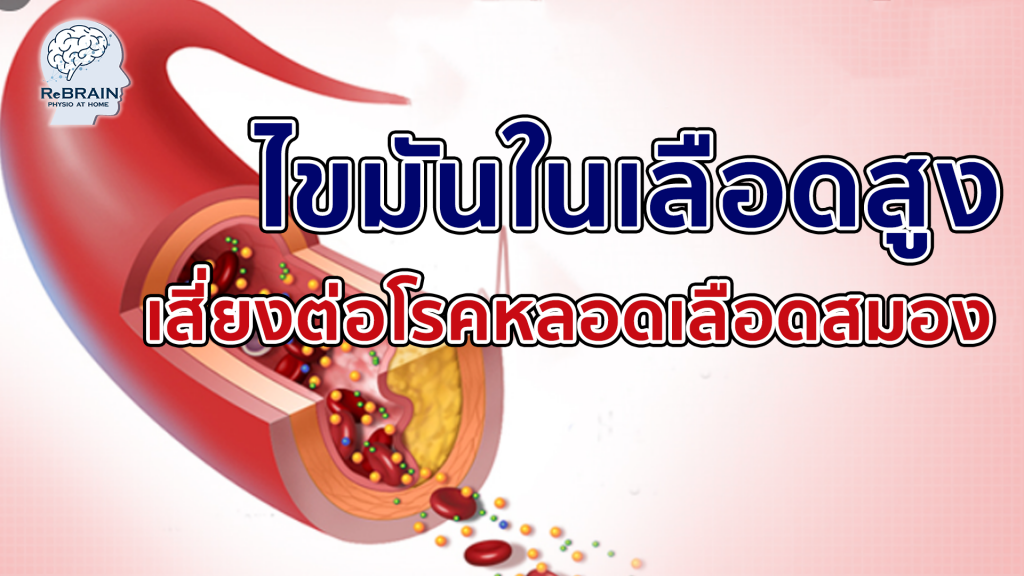 ไขมันในเลือดสูง