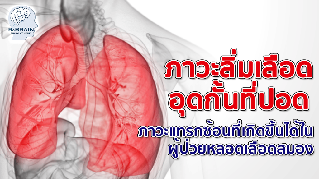 ภาวะลิ่มเลือดอุดกั้นที่ปอด