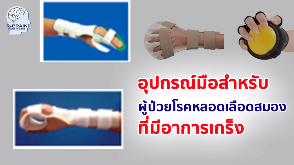 อุปกรณ์มือสำหรับผู้ป่วยโรคหลอดเลือดสมอง ที่มีอาการเกร็ง